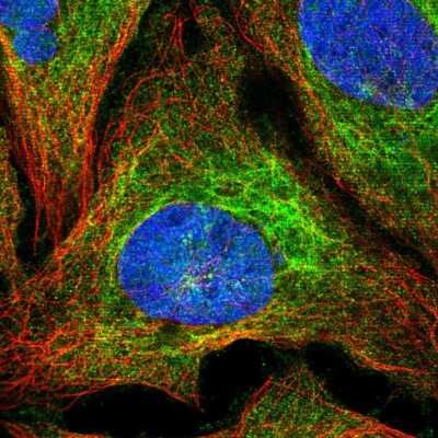 Immunocytochemistry/Immunofluorescence: EAAT4 Antibody [NBP2-48805] - Staining of human cell line U-2 OS shows localization to intermediate filaments. Antibody staining is shown in green.