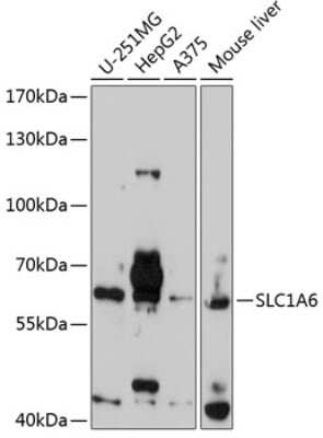 Western Blot: EAAT4 Antibody [NBP2-92419] - Analysis of extracts of various cell lines, using EAAT4 at 1:1000 dilution. Secondary antibody: HRP Goat Anti-Rabbit IgG (H+L) at 1:10000 dilution. Lysates/proteins: 25ug per lane. Blocking buffer: 3% nonfat dry milk in TBST. Detection: ECL Basic Kit . Exposure time: 90s.