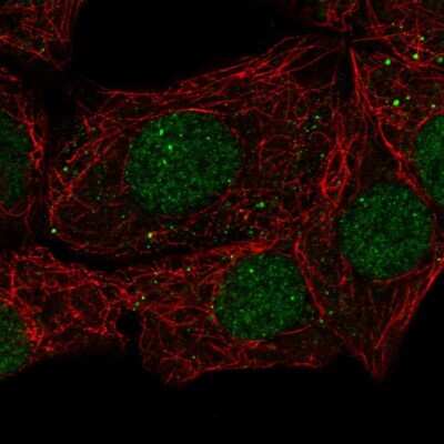 Immunocytochemistry/Immunofluorescence: EAF1 Antibody [NBP2-57007] - Staining of human cell line MCF7 shows localization to nucleoplasm, nuclear bodies & vesicles.