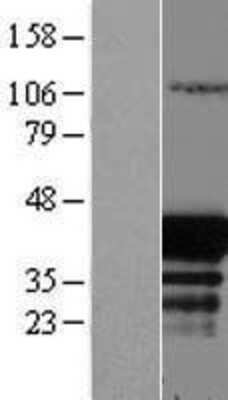 Western Blot: EAF1 Overexpression Lysate (Adult Normal) [NBL1-10087] Left-Empty vector transfected control cell lysate (HEK293 cell lysate); Right -Over-expression Lysate for EAF1.