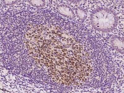 Immunohistochemistry-Paraffin: EAF2 Antibody [NBP2-97559] - Immunochemical staining of human EAF2 in human appendix with rabbit polyclonal antibody at 1:200 dilution, formalin-fixed paraffin embedded sections.