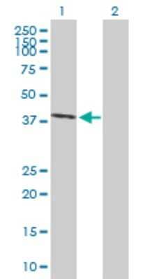 Western Blot: EAF2 Antibody [H00055840-B01P] - Analysis of EAF2 expression in transfected 293T cell line by EAF2 polyclonal antibody.  Lane 1: EAF2 transfected lysate(28.6 KDa). Lane 2: Non-transfected lysate.