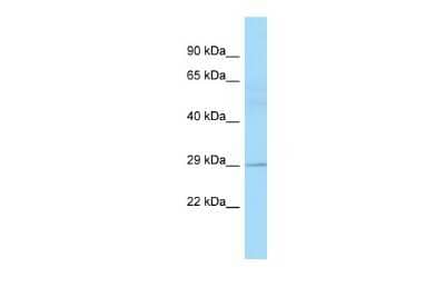 Western Blot: EAF2 Antibody [NBP2-86622] - WB Suggested Anti-EAF2 Antibody. Titration: 1.0 ug/ml. Positive Control: Fetal Lung