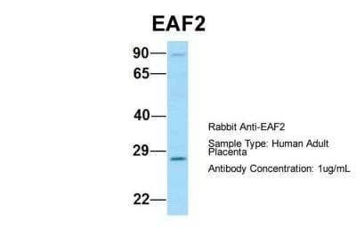 Western Blot: EAF2 Antibody [NBP2-86622] - Host: Rabbit. Target Name: EAF2. Sample Type: Human Adult Placenta. Antibody Dilution: 1.0ug/ml