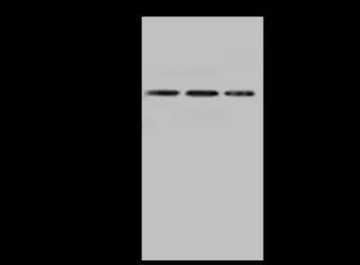 Western Blot: EAF2 Antibody [NBP2-97559] - Anti-EAF2 rabbit polyclonal antibody at 1:500 dilution. Lane A: HepG2 Whole Cell Lysate Lane B: A431 Whole Cell Lysate Lane C: 293T Whole Cell Lysate Lysates/proteins at 30 ug per lane. Secondary Goat Anti-Rabbit IgG (H+L)/HRP at 1/10000 dilution. Developed using the ECL technique. Performed under reducing conditions. Predicted band size: 29 kDa. Observed band size: 45 kDa