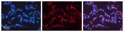 Immunohistochemistry-Paraffin: EAR2/NR2F6 Antibody [NBP2-86623] - NR2F6 antibody - N-terminal region. Formalin Fixed Paraffin Embedded Tissue: Human Lung Tissue. Observed Staining: Nucleus of pneumocytes. Primary Antibody Concentration: 1:100.