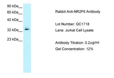 Western Blot: EAR2/NR2F6 Antibody [NBP2-86623] - WB Suggested Anti-NR2F6 Antibody. Titration: 0.2 ug/ml. Positive Control: Jurkat Whole Cell