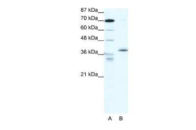 Western Blot: EAR2/NR2F6 Antibody [NBP2-86624] - WB Suggested Anti-NR2F6 Antibody. Titration: 5 ug/ml. Positive Control: HepG2 Whole CellNR2F6 is strongly supported by BioGPS gene expression data to be expressed in Human HepG2 cells