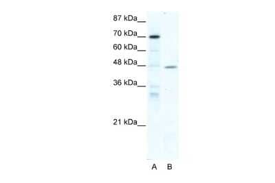 Western Blot: EAR2/NR2F6 Antibody [NBP2-86625] - WB Suggested Anti-NR2F6 Antibody Titration: 5.0ug/ml. ELISA Titer: 1:1562500. Positive Control: HepG2 cell lysateNR2F6 is strongly supported by BioGPS gene expression data to be expressed in Human HepG2 cells