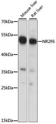 Western Blot: EAR2/NR2F6 Antibody [NBP2-92225] - Analysis of extracts of various cell lines, using EAR2/NR2F6 at 1:1000 dilution.Secondary antibody: HRP Goat Anti-Rabbit IgG (H+L) at 1:10000 dilution.Lysates/proteins: 25ug per lane.Blocking buffer: 3% nonfat dry milk in TBST.Detection: ECL Basic Kit .Exposure time: 1S.