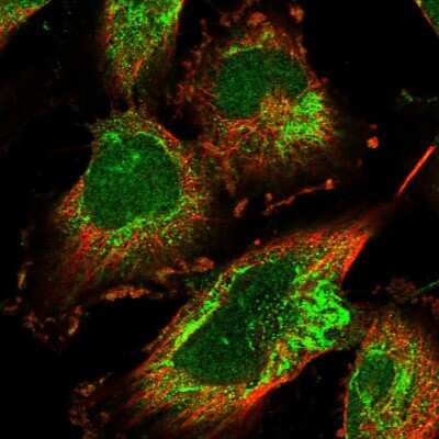 Immunocytochemistry/Immunofluorescence: EARS2 Antibody [NBP1-91857] - Staining of human cell line U-251 MG shows localization to nucleoplasm & mitochondria. Antibody staining is shown in green.