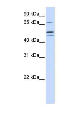 Western Blot: EARS2 Antibody [NBP1-56400] - 721_B cell lysate, concentration 0.2-1 ug/ml.