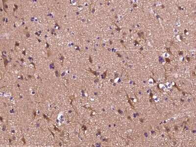 Immunohistochemistry-Paraffin: EB3 Antibody [NBP3-00342] - Immunochemical staining of human EB3 in human brain with rabbit polyclonal antibody (1:2000, formalin-fixed paraffin embedded sections).
