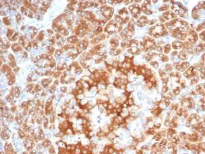 Immunohistochemistry-Paraffin: EBAG9/RCAS1 Antibody (EBAG9/7033R) [NBP3-13811] - Formalin-fixed, paraffin-embedded human salivary gland stained with EBAG9/RCAS1 antibody (EBAG9/7033R).