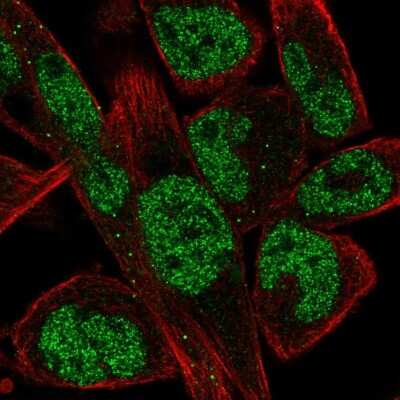 Immunocytochemistry/Immunofluorescence: EBF-1 Antibody [NBP2-56773] - Staining of human cell line RH-30 shows localization to nucleoplasm & vesicles.