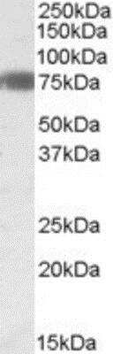 Western Blot: EBF-1 Antibody [NBP1-28471] -  Analysis of EBF1 in Human Adipose lysate (35ug protein in RIPA buffer) using this antibody at 0.3 ug/ml. Primary incubation was 1 hour. Detected by chemiluminescence.