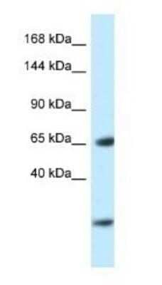 Western Blot: EBF-3 Antibody [NBP1-82378] - Rat Lung lysate, concentration 1 ug/ml.