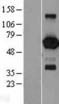 Western Blot: EBF1 Overexpression Lysate (Adult Normal) [NBL1-10091] Left-Empty vector transfected control cell lysate (HEK293 cell lysate); Right -Over-expression Lysate for EBF1.