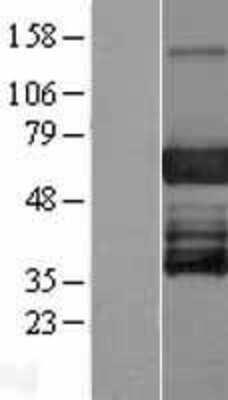 Western Blot: EBF3 Overexpression Lysate (Adult Normal) [NBP2-08863] Left-Empty vector transfected control cell lysate (HEK293 cell lysate); Right -Over-expression Lysate for EBF3.