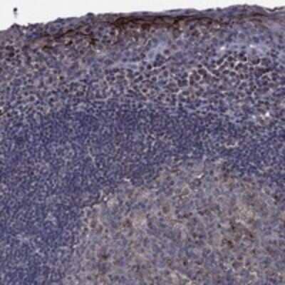 Immunohistochemistry-Paraffin: EBI2/GPR183 Antibody [NBP3-17788] - Staining of human tonsil shows strong cytoplasmic positivity in subsets of germinal center, non-germinal center and squamous epithelial cells.
