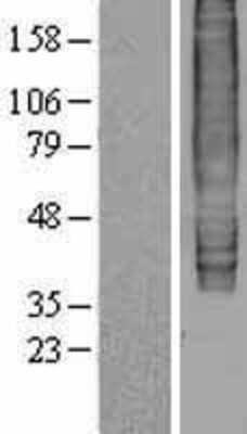 Western Blot: EBI2/GPR183 Overexpression Lysate (Adult Normal) [NBL1-10092] Left-Empty vector transfected control cell lysate (HEK293 cell lysate); Right -Over-expression Lysate for EBI2/GPR183.