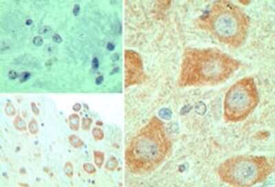 Immunohistochemistry-Paraffin: EBI3 Antibody Pack [NBP2-29379] - Analysis of EBI3 in formalin-fixed, paraffin-embedded mouse brain tissue using an isotype control (top left) and anti-EBI3 antibody (bottom left, right) at 5 ug/ml.