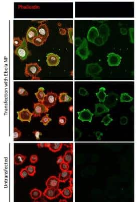 Immunocytochemistry/Immunofluorescence: EBOV Antibody [NBP3-14861] - Hela cells were transfected with plasmids expressing Ebola Zaire glycoprotein, nucleoprotein or VP40, seeded on coverslips and incubated for 48 h. Control coverslips consisted of untransfected cells. After fixation with 4% PFA, samples were stained with EBOV antibody. Antibody was used at a dilution of 1:500 and Triton X-100 was used as detergent. Imaging was performed using a Leica SP5 confocal microscope (Images by Virology Research Services Ltd).