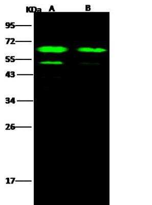 Western Blot: EBOV GP Antibody [NBP3-12732] - Ebola virus EBOV (Subtype Sudan, strain Gulu) Glycoprotein / GP Recombinant ProteinLane A: 50ngLane B: 10ngSecondaryGoat Anti- Rabbit IgG H&L (Dylight 800) at 1/10000 dilution.Developed using the Odyssey technique. Performed under reducing conditions.