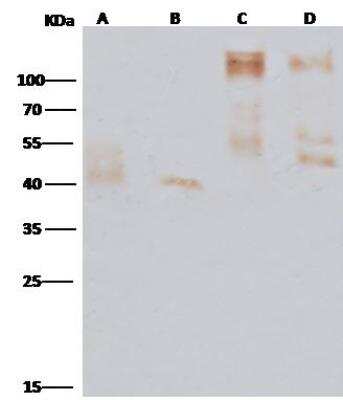 Western Blot: EBOV GP Antibody [NBP3-12747] - Anti-Ebola virus EBOV (subtype Zaire, strain Mayinga 1976) Glycoprotein / GP rabbit polyclonal antibody at 1:5000 dilutionLane A:Ebola virus EBOV (subtype Zaire, strain H.sapiens-wt/GIN/2014/Kissidougou-C15) Glycoprotein / GP at 10ngLane B:GP (B-EBOV-2007) at 10ngLane C:Ebola virus EBOV (subtype Zaire, strain Mayinga 1976) Glycoprotein / GP at 10ngLane D:Ebola virus EBOV (Subtype Sudan, strain Gulu) Glycoprotein / GP Protein (aa:Met1-Asn637) at 10ngSecondaryHRP Conjugated Goat-anti-Rabbit IgG (H+L) at 1/1000 dilutionPerformed under reducing conditions.