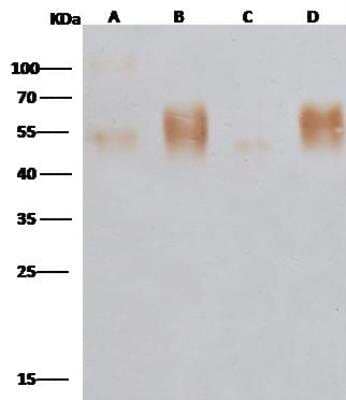 Western Blot: EBOV GP Antibody [NBP3-12748] - Anti-Ebola virus EBOV (subtype Zaire, strain Mayinga 1976) GP-RBD / Glycoprotein rabbit polyclonal antibody at 1:5000 dilutionLane A: Ebola virus EBOV (subtype Zaire, strain Mayinga 1976) Glycoprotein / GP(10ng)Lane B: Ebola virus EBOV (subtype Zaire, strain Mayinga 1976) GP-RBD / Glycoprotein(10ng)Lane C: Ebola virus EBOV (Subtype Sudan, strain Gulu) Glycoprotein / GP1 (mucin domain deleted) Protein (aa:Met1-Asp320)(10ng)Lane D: Ebola virus EBOV (subtype Zaire, strain H.sapiens-wt/GIN/2014/Kissidougou-C15) Glycoprotein / GP-RBD Protein(10ng) SecondaryHRP Conjugated Goat-anti-Rabbit IgG (H+L) at 1/1000 dilutionPerformed under reducing conditions.