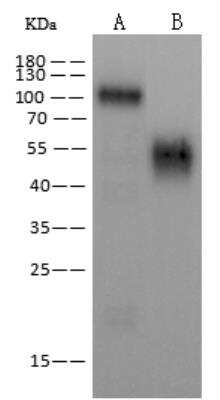 Western Blot: EBOV GP Antibody [NBP3-12758] - Anti-EBOV rabbit polyclonal antibody at 1:2000 dilutionLane A: Ebola virus EBOV (subtype Zaire, strain H.sapiens-wt/GIN/2014/Kissidougou-C15) Glycoprotein / GP Protein (2ng)Lane B: Ebola virus EBOV (subtype Zaire, strain H.sapiens-wt/GIN/2014/Kissidougou-C15) Glycoprotein / GP-RBD Protein  (2ng)Secondary: Goat Anti-Rabbit IgG H&L (Dylight800) at 1/10000 dilution.Developed using the Odyssey technique.Performed under reducing conditions.