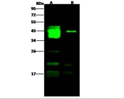 Western Blot: EBOV GP1 Antibody [NBP3-05820] - Ebola virus EBOV (subtype Bundibugyo, strain Uganda 2007) GP1 / Glycoprotein Recombinant Protein Lane A: 50ngLane B: 10ngSecondaryGoat Anti- Rabbit IgG H&L (Dylight 800) at 1/10000 dilution.Developed using the Odyssey technique. Performed under reducing conditions.