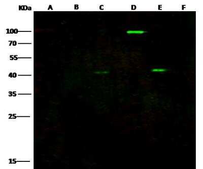 Western Blot: EBOV VP40 protein Antibody [NBP3-12760] - nti-Ebola virus EBOV (subtype Zaire, strain H.sapiens-wt/GIN/2014/Kissidougou-C15) Matrix protein VP40 rabbit polyclonal antibody at 1:5000 dilutionLane A: Ebola virus EBOV (subtype Sudan, strain Gulu) VP40 / Matrix protein VP40 Protein (10ng)Lane B: Ebola virus EBOV (subtype Sudan, strain Gulu) VP40 / Matrix protein VP40 Protein (10ng)Lane C: Ebola virus EBOV (subtype Bundibugyo, strain Uganda 2007) VP40 (10ng)Lane D: Ebola virus EBOV (subtype Zaire, strain H.sapiens-wt/GIN/2014/Kissidougou-C15) VP40 (10ng)Lane E: Ebola virus EBOV (subtype Zaire, strain H.sapiens-wt/GIN/2014/Kissidougou-C15) Matrix protein VP40 Protein(10ng)Lane F: Human CLIC1(10ng)SecondaryDylight 800-labeled Antibody To Rabbit IgG (H+L) at 1:5000 dilution.Developed using the Odyssey technique.Performed under reducing conditions.