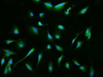 Immunocytochemistry/Immunofluorescence: EBP Antibody [NBP3-06227] - Immunofluorescence staining of EBP in U251MG cells. Cells were fixed with 4% PFA, permeabilzed with 0.1% Triton X-100 in PBS,blocked with 10% serum, and incubated with rabbit anti-Human EBP polyclonal antibody (dilution ratio 1:200) at 4 degrees celsius overnight. Then cells were stained with the Alexa Fluor (TM) 488-conjugated Goat Anti-rabbit IgG secondary antibody (green) and counterstained with DAPI (blue).Positive staining was localized to Cytoplasm.