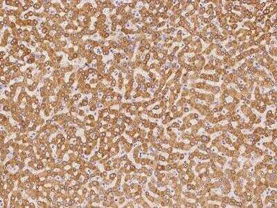 Immunohistochemistry-Paraffin: EBP Antibody [NBP3-06227] - Immunochemical staining of human EBP in human liver with rabbit polyclonal antibody at 1:100 dilution, formalin-fixed paraffin embedded sections.