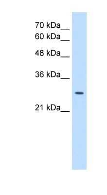 Western Blot: EBP Antibody [NBP1-59782] - Jurkat cell lysate, concentration 0.2-1 ug/ml.