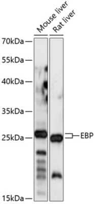 Western Blot: EBP Antibody [NBP2-92189] - Analysis of extracts of various cell lines, using EBP at 1:1000 dilution.Secondary antibody: HRP Goat Anti-Rabbit IgG (H+L) at 1:10000 dilution.Lysates/proteins: 25ug per lane.Blocking buffer: 3% nonfat dry milk in TBST.Detection: ECL Basic Kit .Exposure time: 5s.