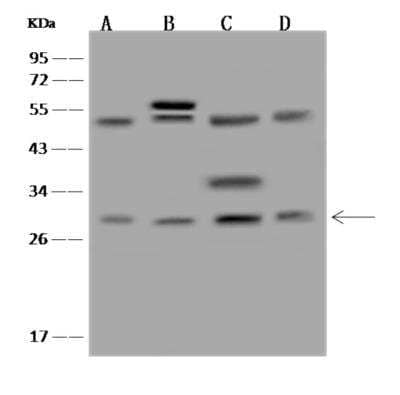 Western Blot: EBP Antibody [NBP3-06227] - Anti-EBP rabbit polyclonal antibody at 1:500 dilutionLane A: MCF-7 Whole Cell LysateLane B: Jurkat Whole Cell LysateLane C: A549 Whole Cell LysateLane D: 293T Whole Cell LysateLysatesroteins at 30 ug per lane.Secondary: Goat Anti-Rabbit IgG (H+L)HRP at 110000 dilution.Developed using the ECL technique. Performed under reducing conditions.Predicted band size:26 kDaObserved band size:28 kDa(We are unsure as to the identity of these extra bands.)