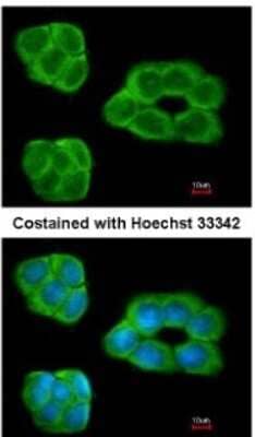 Immunocytochemistry/Immunofluorescence: EBP1 Antibody [NBP2-16257] - Analysis of methanol-fixed A431, using antibody at 1:200 dilution.