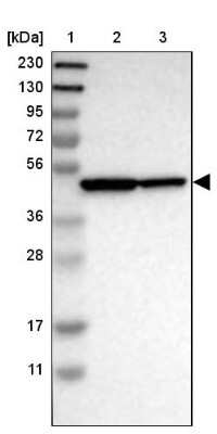 Western Blot: EBP1 Antibody [NBP1-90369] - Lane 1: Marker  [kDa] 230, 130, 95, 72, 56, 36, 28, 17, 11.  Lane 2: Human cell line RT-4.  Lane 3: Human cell line U-251MG sp