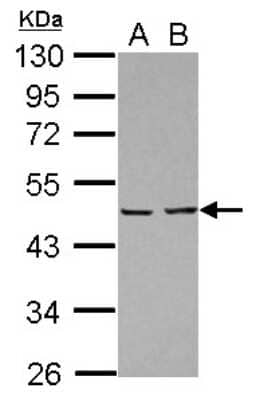 Western Blot: EBP1 Antibody [NBP2-16256] - Sample (30 ug of whole cell lysate) A: A431 B: Jurkat 10% SDS PAGE gel, diluted at 1:10000.