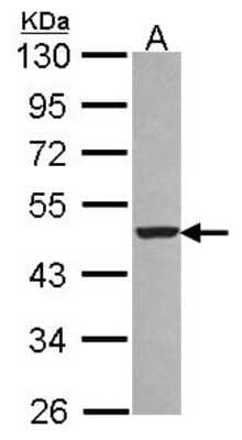 Western Blot: EBP1 Antibody [NBP2-16257] - Sample (30 ug of whole cell lysate) A: A431 10% SDS PAGE gel, diluted at 1:1000.