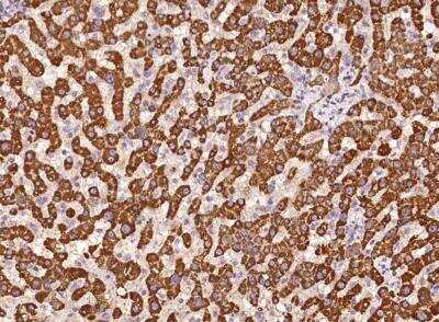 Immunohistochemistry-Paraffin: EBPL Antibody [NBP3-05841] - Staining of human EBPL in human liver with rabbit polyclonal antibody at 1:100 dilution.