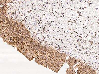 Immunohistochemistry-Paraffin: EBPL Antibody [NBP3-05841] - Staining of human EBPL in human urinary bladder with rabbit polyclonal antibody at 1:100 dilution.