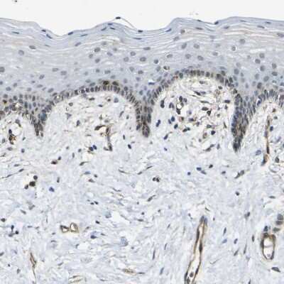 Immunohistochemistry-Paraffin: ECE-1 Antibody [NBP1-84016] - Staining of human vagina shows strong positivity in endothelial cells.