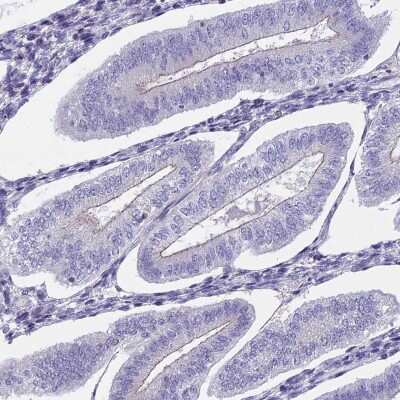 Immunohistochemistry-Paraffin: ECE-2 Antibody [NBP1-81495] - Staining of human endometrium shows low expression as expected.