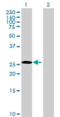 Western Blot: ECE-2 Antibody [H00009718-B01P] - Analysis of ECE2 expression in transfected 293T cell line by ECE2 polyclonal antibody.  Lane 1: ECE2 transfected lysate(28.05 KDa). Lane 2: Non-transfected lysate.