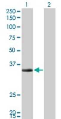 Western Blot: ECH1 Antibody (5G8) [H00001891-M01] - Analysis of ECH1 expression in transfected 293T cell line by ECH1 monoclonal antibody (M01), clone 5G8.Lane 1: ECH1 transfected lysate(35.8 KDa).Lane 2: Non-transfected lysate.