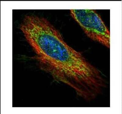 <b>Genetic Strategies Validation. </b>Immunocytochemistry/Immunofluorescence: ECH1 Antibody [NBP2-16261] - Confocal immunofluorescence analysis of methanol-fixed HeLa, using ECH1 antibody (Green) at 1:500 dilution. Alpha-tubulin filaments are labeled with Alpha-tubulin antibody (Red) at 1:2000.