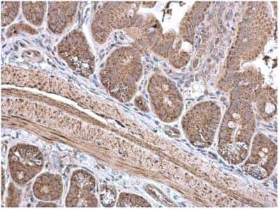 Immunohistochemistry-Paraffin: ECH1 Antibody [NBP1-31662] - Sample: Paraffin-embedded mouse intestine.  ECH1 antibody diluted at 1:500.